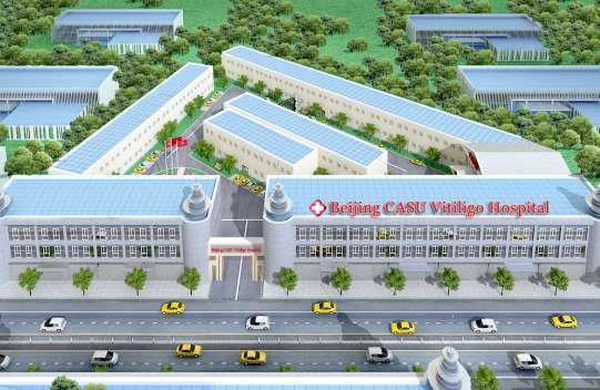 beijing casu vitiligo hospital