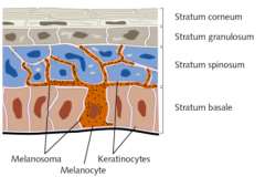 The diagnosis and symptom of vitiligo