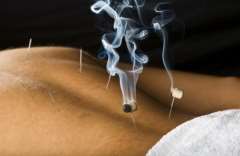 The Chinese treatment-acupuncture and moxib