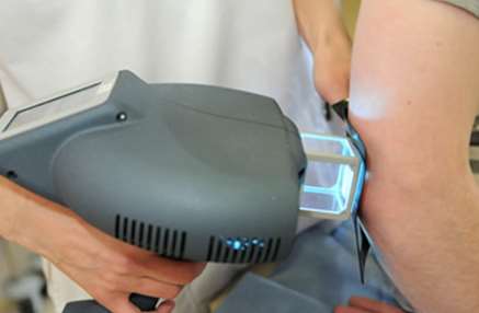 laser treatment