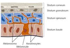 Find the causes of your vitiligo and treat 