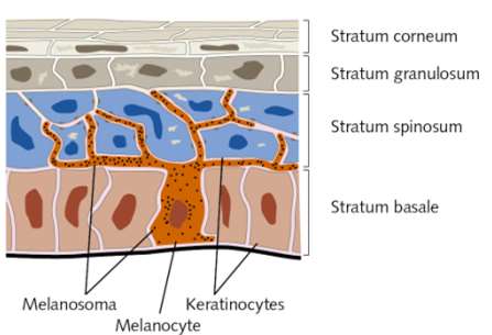 vitiligo causes