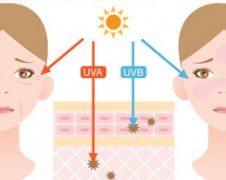 Does UV Light Treat Vitiligo ?