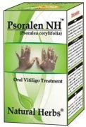 Why Psoralen Can Treat Vitiligo?