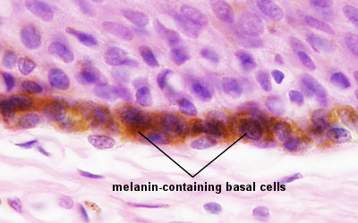 melancytes