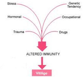 vitiligo causes