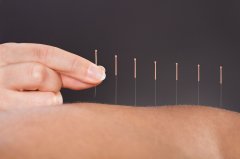 Apply Acupuncture To Treat Vitiligo