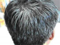 Could Young Person With Grey Hair Be The Sy