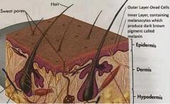 What is the Isomorphic Response of Vitiligo