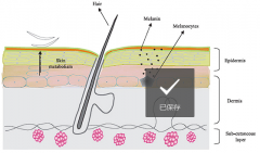 The Role of Melanocytes in the Pathogenesis