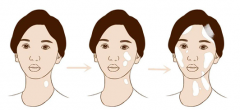 How to Determine the Condition of Vitiligo?