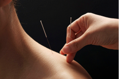 How to use Acupuncture to Treat Vitiligo?