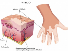 What are the factors that affect the treatm